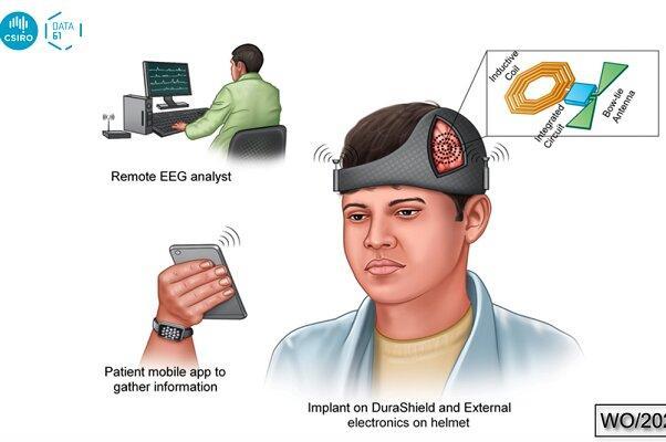 کلاه هوشمندی که از تشنج مغزی جلوگیری می&zwnjکند